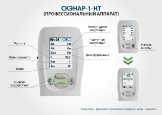 СКЭНАР-1-НТ (исполнение 01)  в Твери купить Скэнар официальный сайт - denasvertebra.ru 